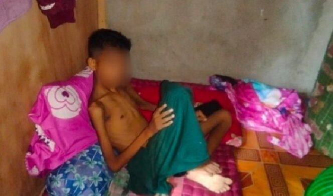 
					Seorang Anak Yatim di Abdya Terbaring Selama 6 Bulan Butuh Uluran Tangan